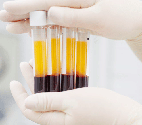 Blood Plasma