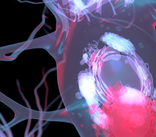Parkinson's Vaccine